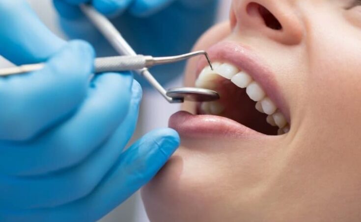 Reasons to purchase Costco dental insurance