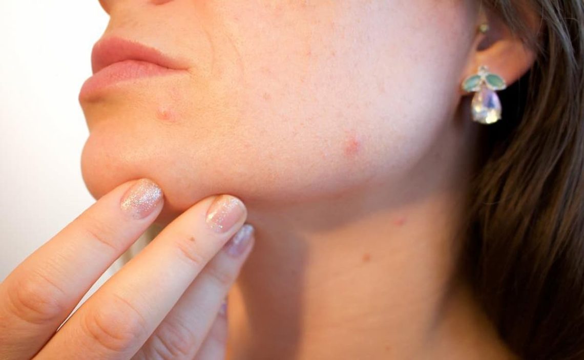 What happens if you visit a dermatologist without health insurance