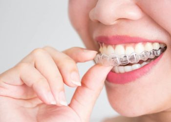 What Insurance covers Invisalign?