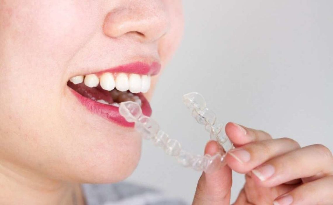 How much do Invisalign braces cost without insurance?