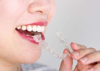 How much do Invisalign braces cost without insurance?
